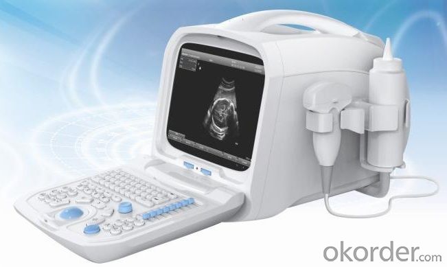 China H1 Tablet Ultrasound Diagnostic System For Medical Apparatus