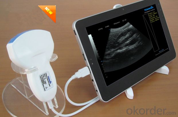 H2vet Handheld Full Digital Ultrasound Scanner