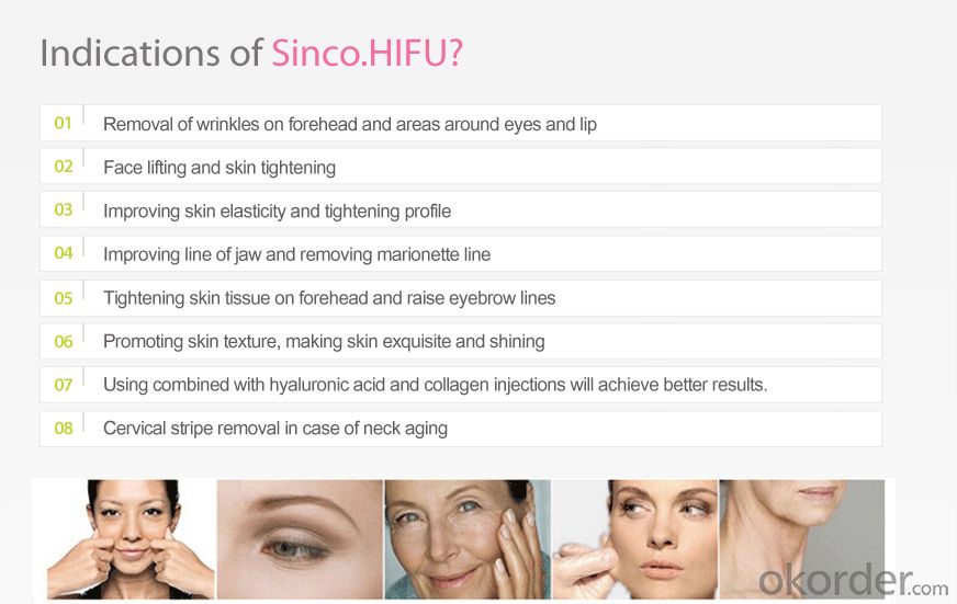 High Intensity Focused Ultrasound Hhifu for Wrinkle Removal / Hifu Face Lift