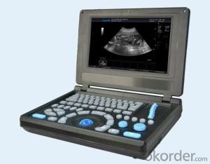 TH-120 Full-digital Ultrasound Diagnostic System