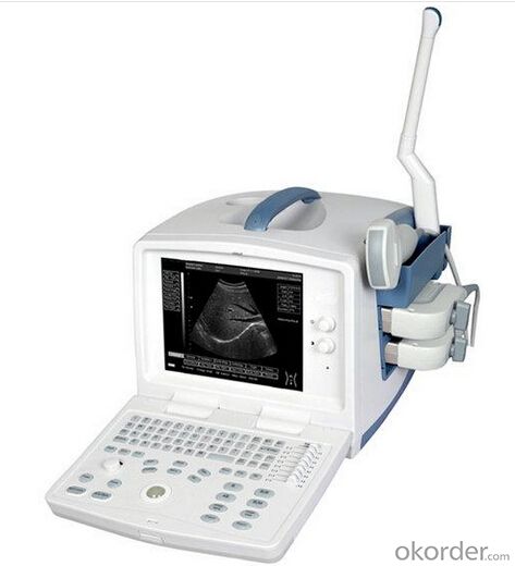 Laptop Design Portable Ultrasound Scanner